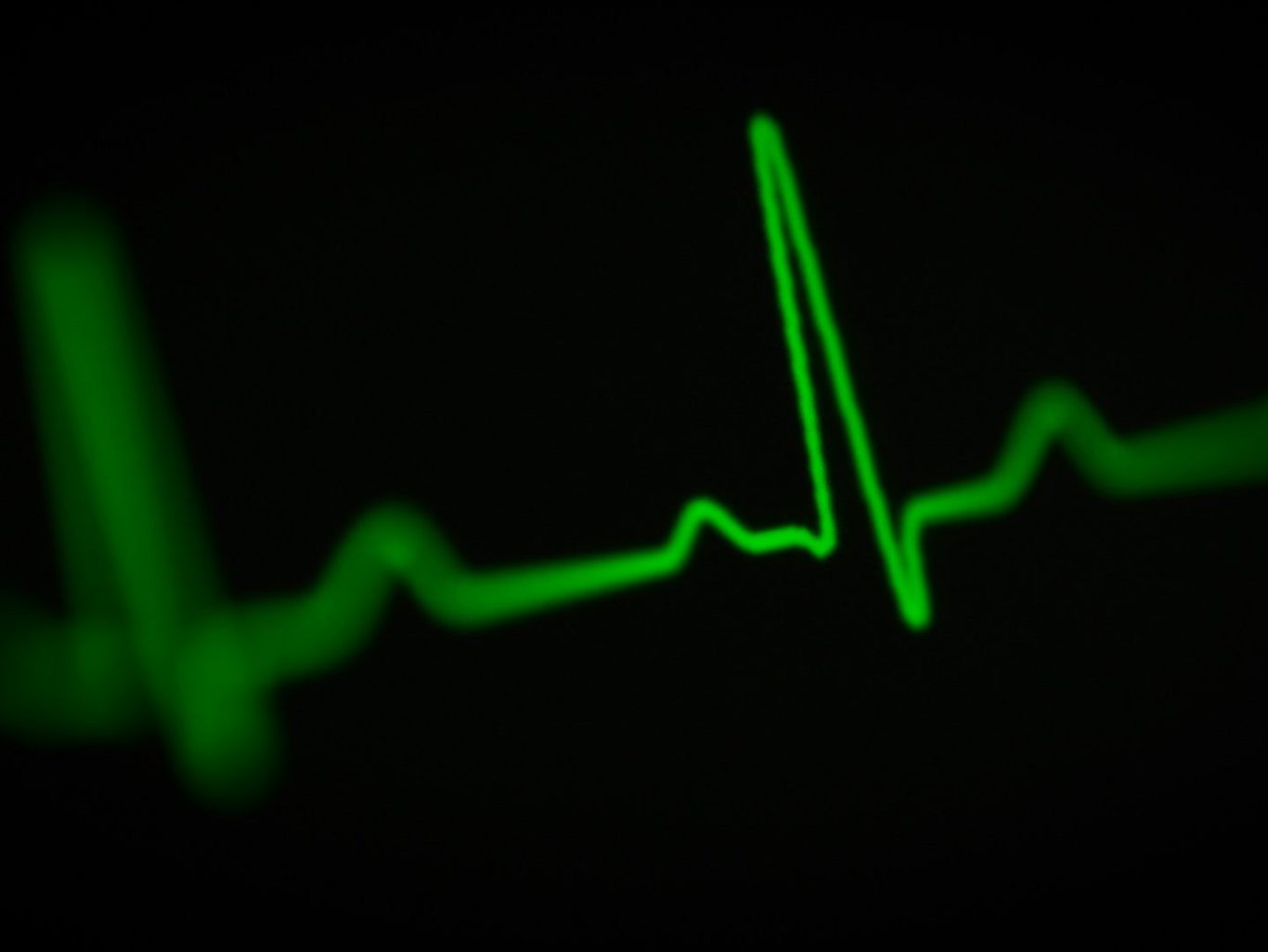 Green electrocardiogram (ECG) line on a black background showing heartbeat patterns.